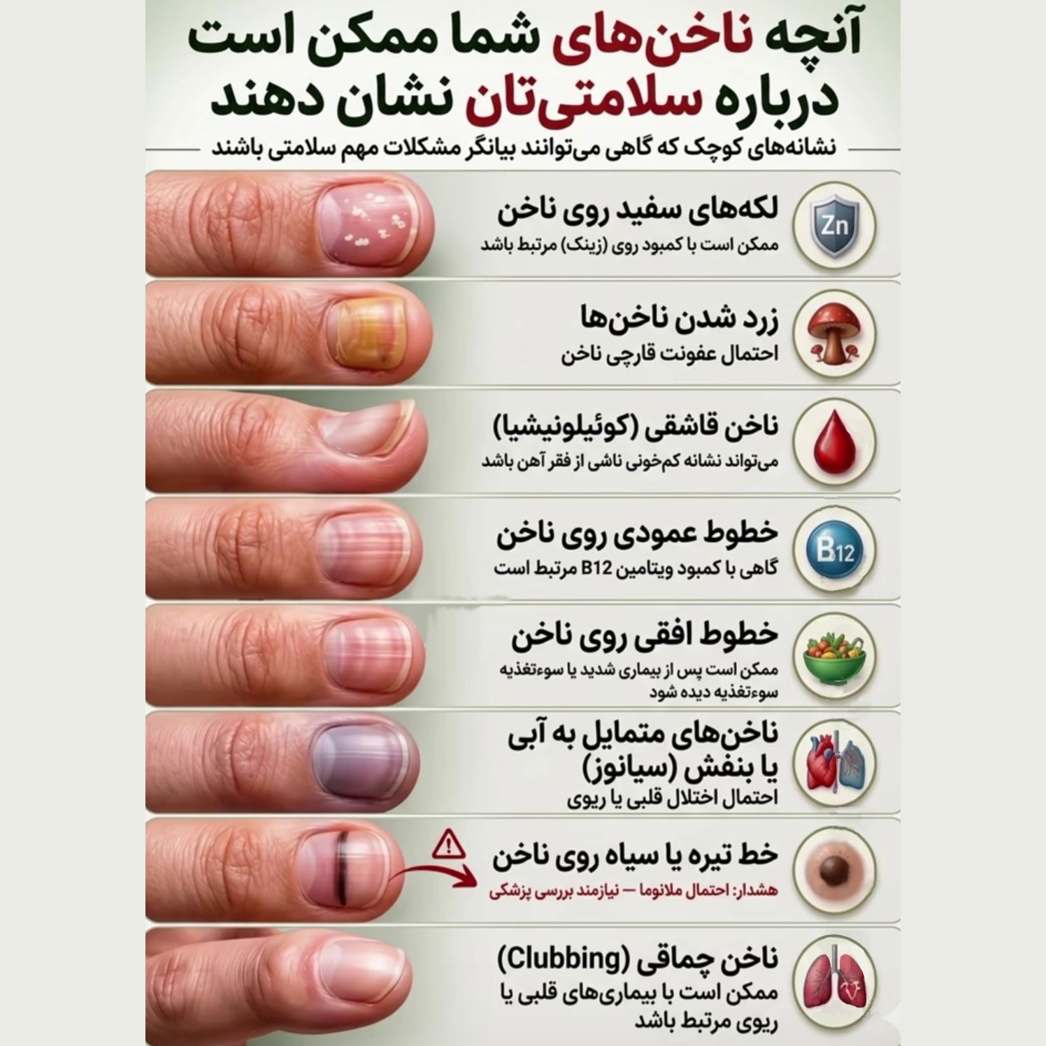 آنچه ناخن های شما ممکن است درباره سلامتی تان نشان دهند