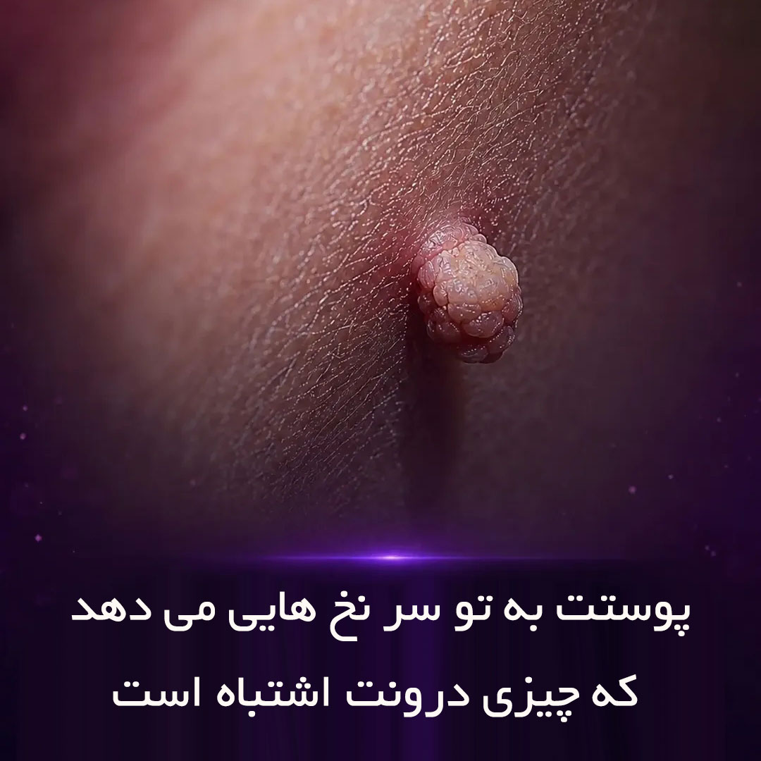 آیا پوست برای بیماری ها سر نخ می دهد ؟