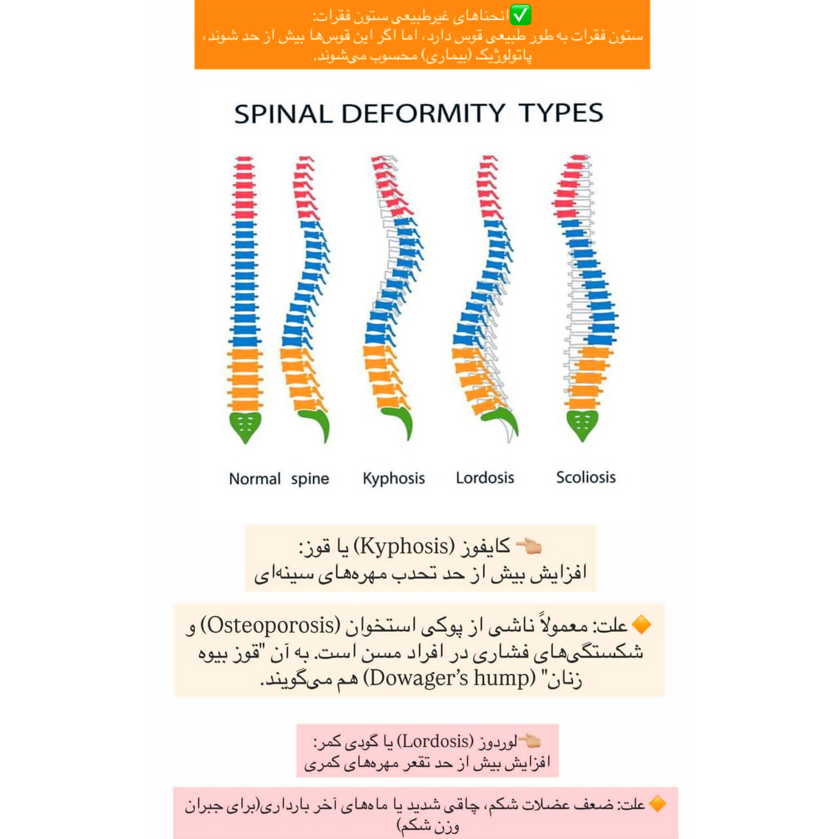انحنا غیر طبیعی ستون فقرات + تفاوت گودی کمر با قوز