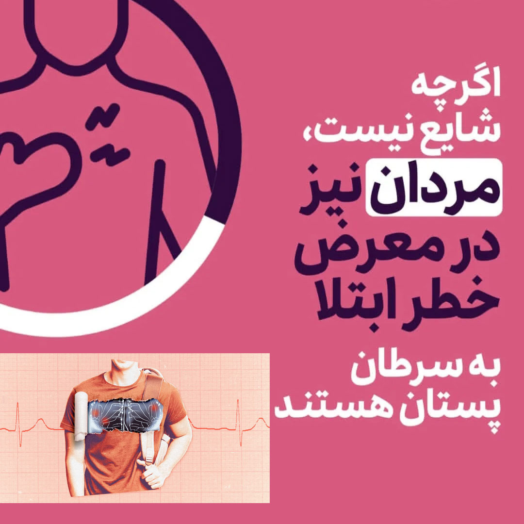 مردان نیز در معرض خطر ابتلا به سرطان پستان هستند اگرچه شایع نیست