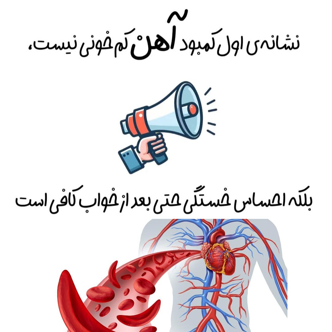 نشانه اول کمبود آهن در بدن چیست ؟