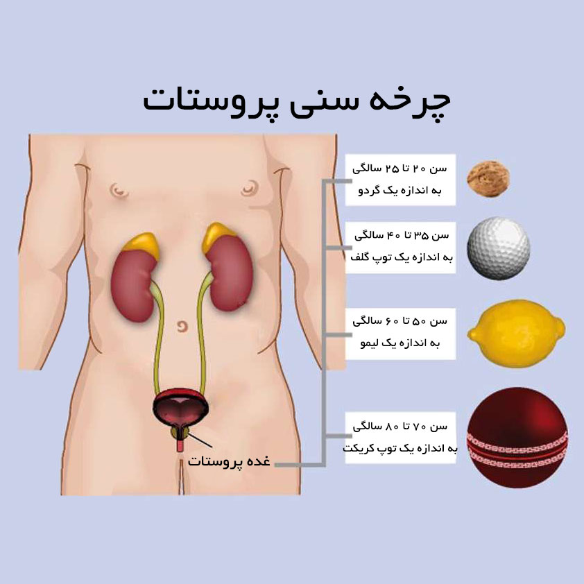 چرخه سنی پروستات و غده پروستات چگونه بزرگ می شود ؟