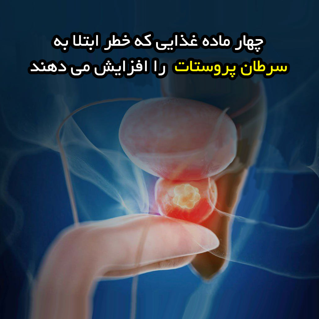 چهار ماده غذایی که خطر ابتلا به سرطان پروستات را افزایش می دهند
